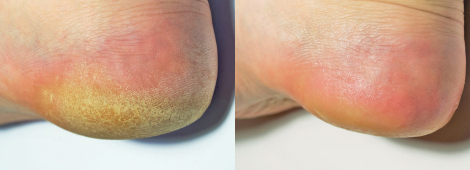 INFORMACIÓN DERMATOLÓGICA