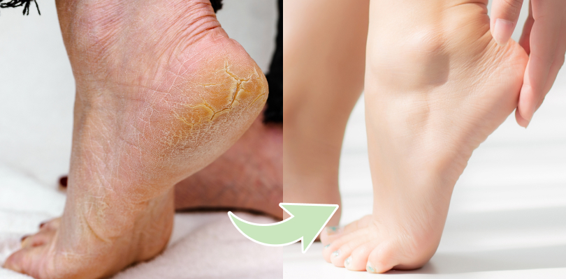 INFORMACIÓN DERMATOLÓGICA