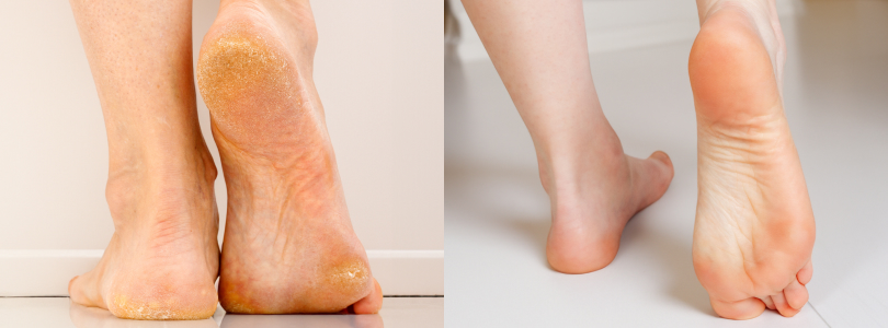 INFORMACIÓN DERMATOLÓGICA