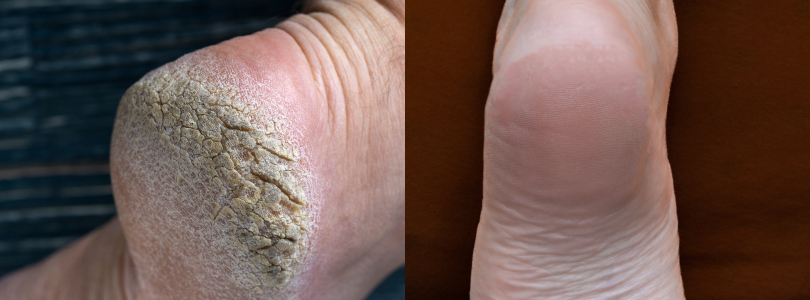INFORMACIÓN DERMATOLÓGICA
