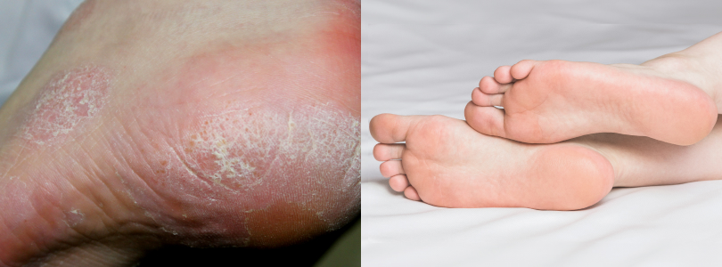 INFORMACIÓN DERMATOLÓGICA
